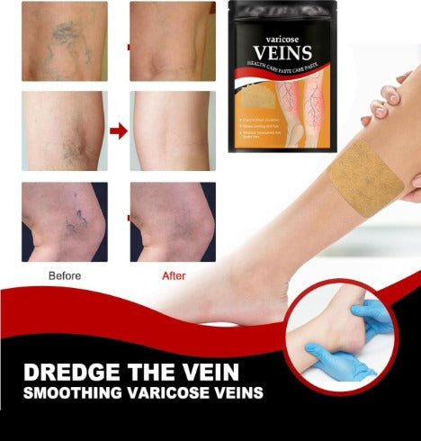 Pack 24 Parches Para El Cuidado De Las Venas